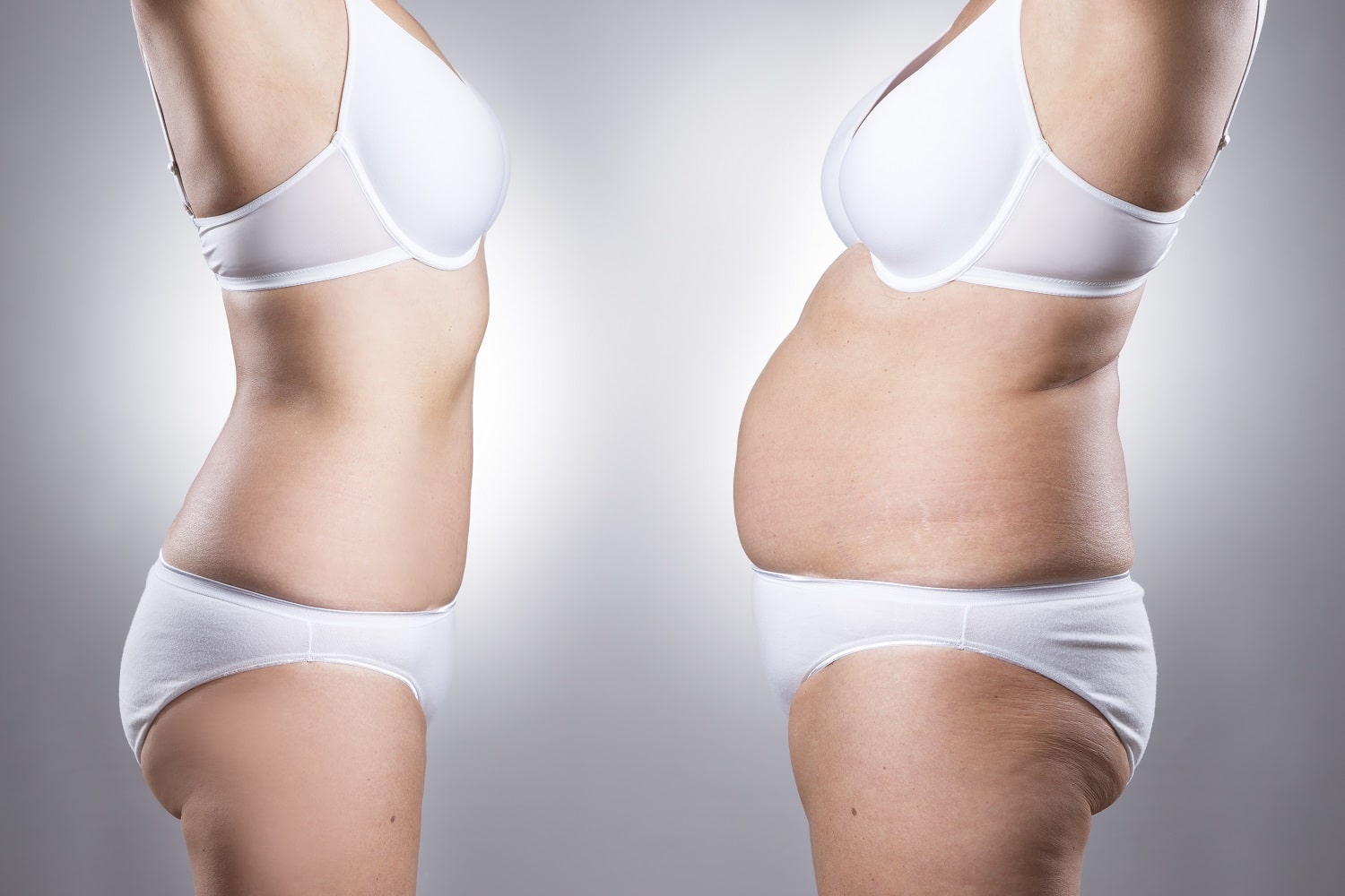 How Can Insurance Cover Tummy Tuck