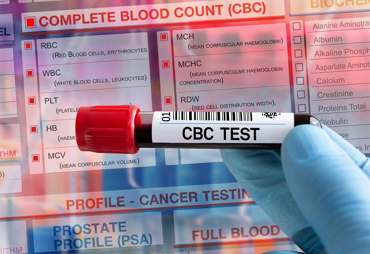 How Much Do Blood Tests Cost Without Insurance
