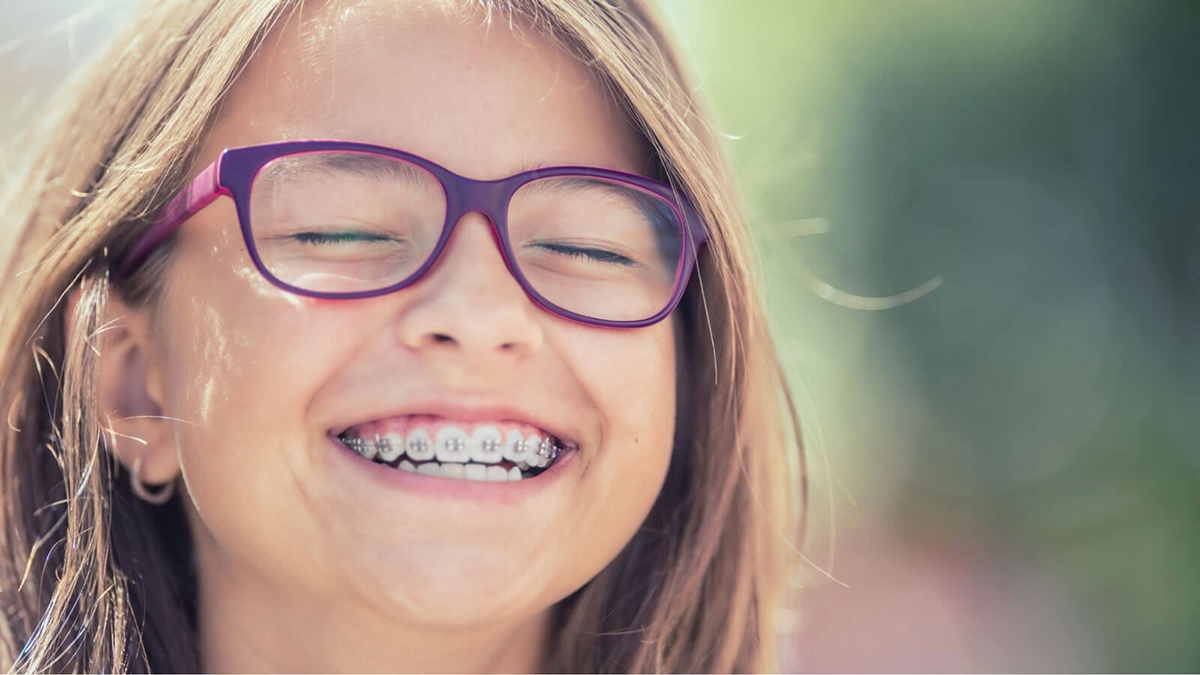 How Much Do Braces Cost In Texas With Insurance?