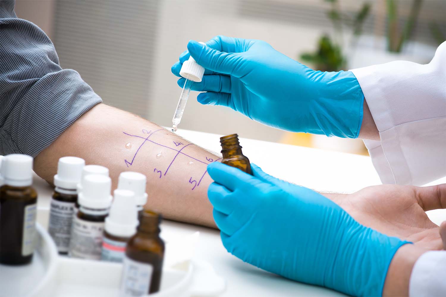 How Much Does Allergy Testing Cost Without Insurance?