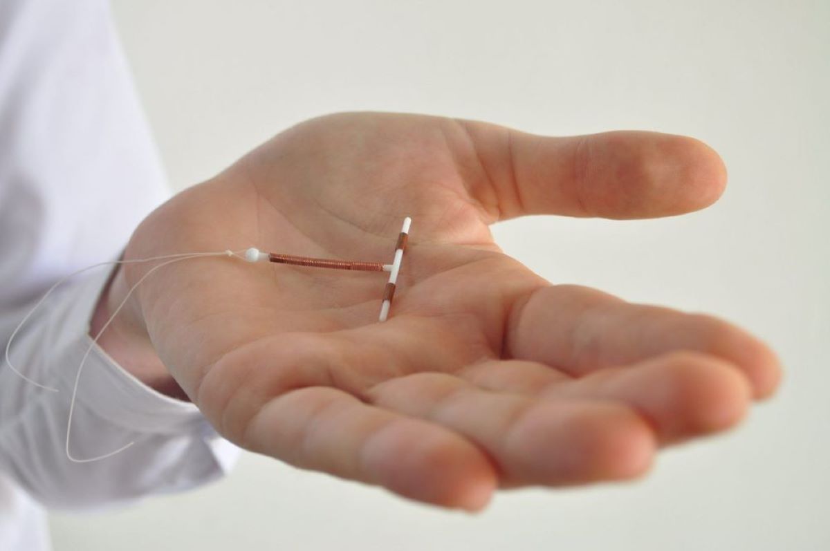How Much Is A Copper IUD Cost Without Insurance