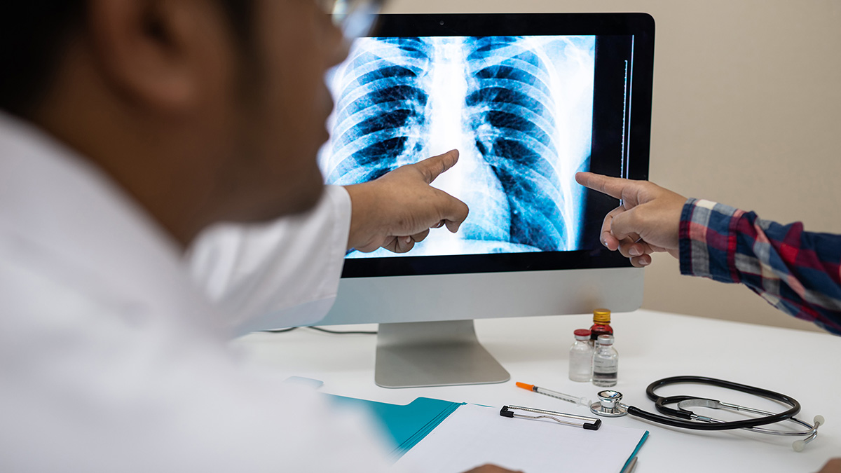 How Much Is A TB Test Without Insurance?