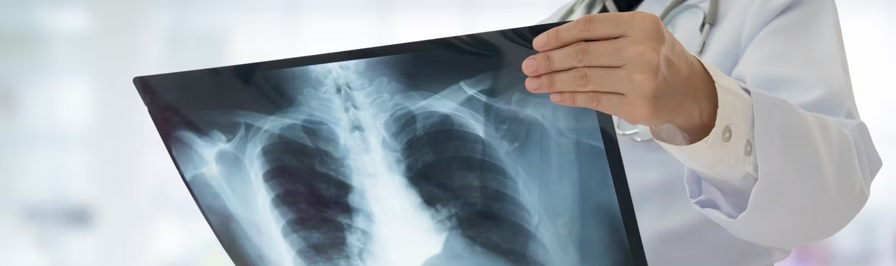 How Much Is An X-Ray Without Insurance?